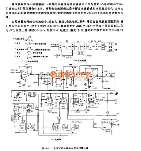 555 acute coronary artery blood-supply insufficiency alarm circuit